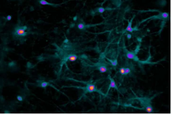 恒达平台官网科学家阐明化学遗传学技术如何劫持神经元活动