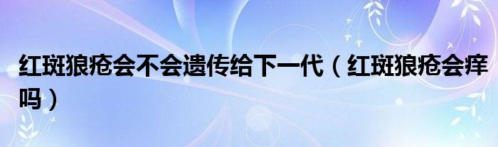 红斑狼疮会不会遗传给下一代（红斑狼疮会痒吗）