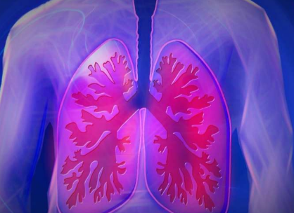 新分析显示机器人支气管镜检查有望改善肺活检