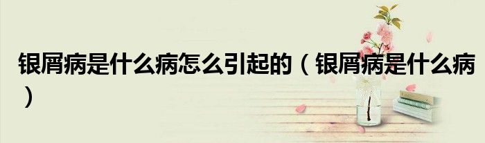银屑病是什么病怎么引起的（银屑病是什么病）
