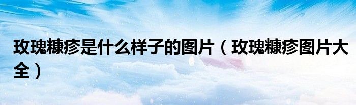 玫瑰糠疹是什么样子的图片（玫瑰糠疹图片大全）