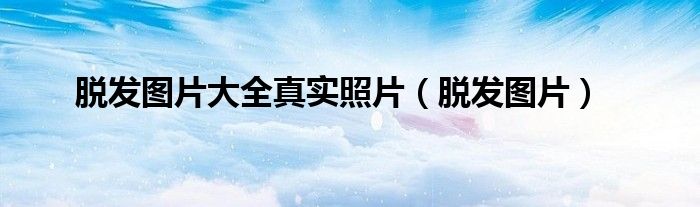 脱发图片大全真实照片（脱发图片）