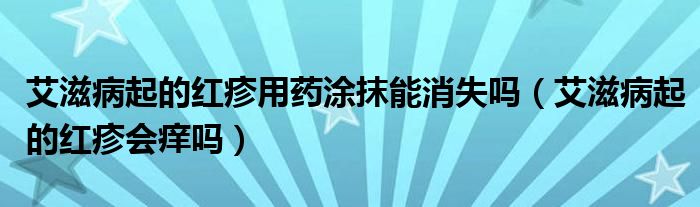 艾滋病起的红疹用药涂抹能消失吗（艾滋病起的红疹会痒吗）