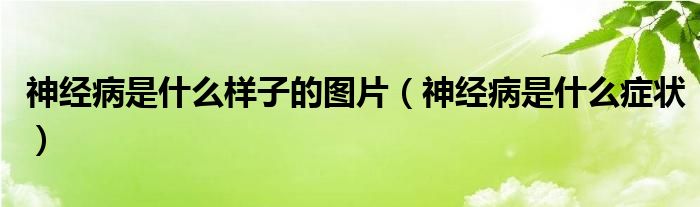 神经病是什么样子的图片（神经病是什么症状）