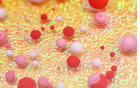 泡沫细胞激发了预测心脏病发作的更好方法