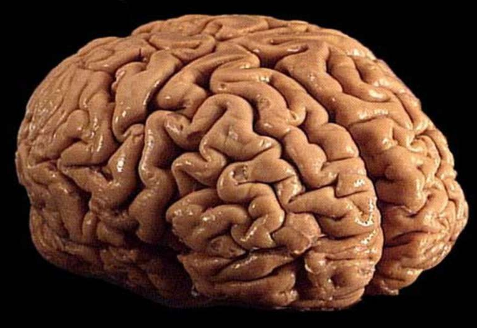 研究确定了人类大脑皮层回旋过度折叠的原因