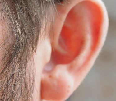 研究人员表示持续的耳垢服务至关重要