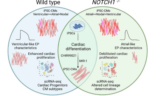 NOTCH1 基因在先天性心脏病中作用的新见解