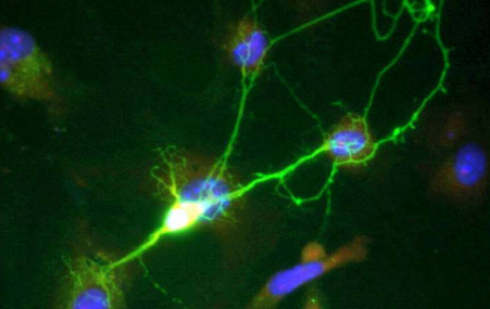 僵尸脑细胞发育成工作神经元