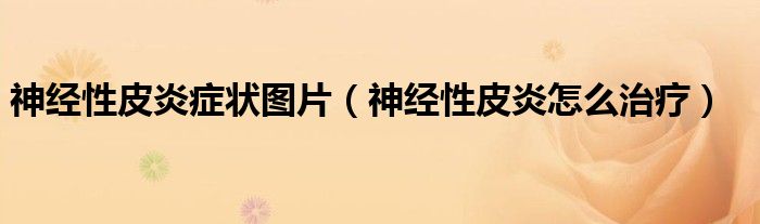 神经性皮炎症状图片（神经性皮炎怎么治疗）