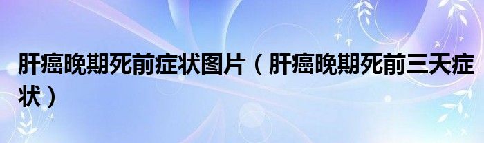 肝癌晚期死前症状图片（肝癌晚期死前三天症状）