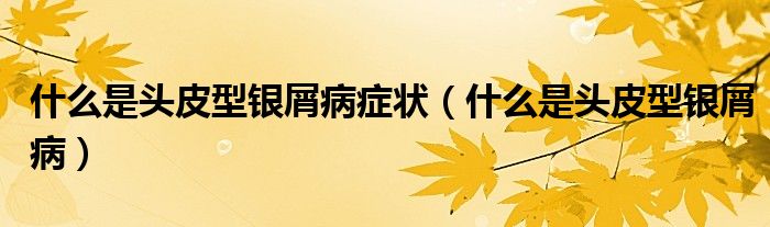 什么是头皮型银屑病症状（什么是头皮型银屑病）