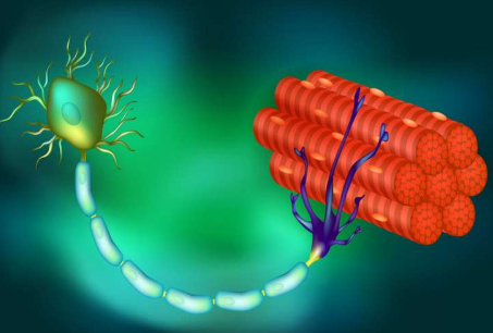 DNA 治疗可以延缓几乎所有 ALS 患者的瘫痪