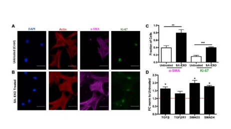 研究：衰老相关的外泌体将纤维化转移到邻近细胞