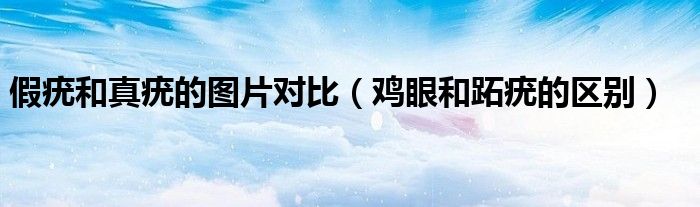 假疣和真疣的图片对比（鸡眼和跖疣的区别）