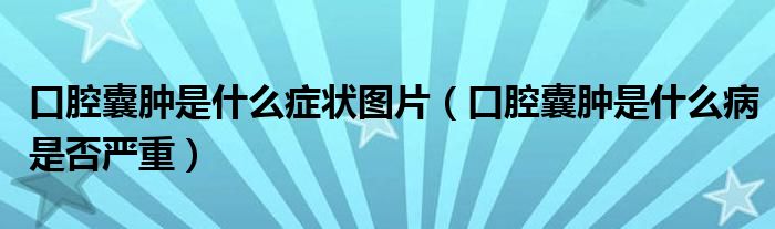 口腔囊肿是什么症状图片（口腔囊肿是什么病是否严重）