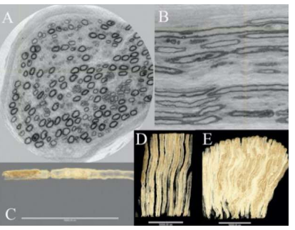 独特的 3-D 图像揭示了神经纤维的结构