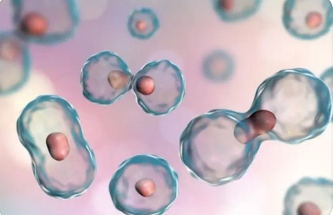 芬兰新生儿线粒体病显示增殖细胞发生癌样变化