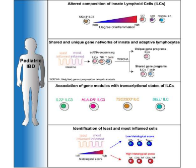 研究人员绘制了 IBD 儿童肠道的免疫学图