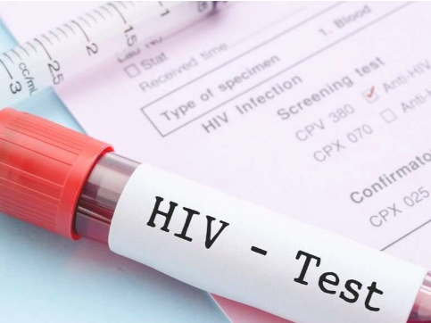 为什么有些人不用药物就能抑制 HIV 的新线索