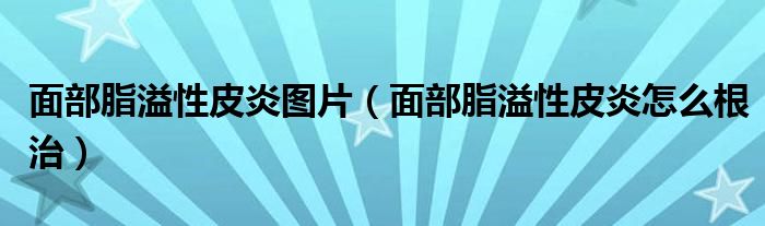 面部脂溢性皮炎图片（面部脂溢性皮炎怎么根治）