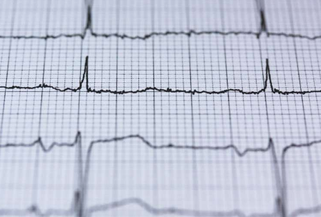 人工智能增强心电图可以加速心力衰竭的诊断和治疗