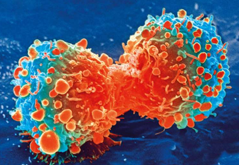 研究表明干扰素γ如何指导癌症免疫治疗的反应