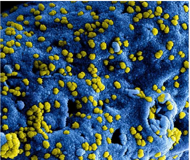 科学家发现对入侵细菌做出有效免疫反应所需的蛋白质