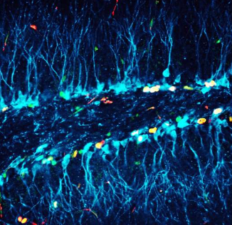 自由基对大脑有益：神经可塑性机制的新见解
