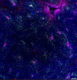 重新连接肿瘤线粒体可增强免疫系统识别和对抗癌症的能力