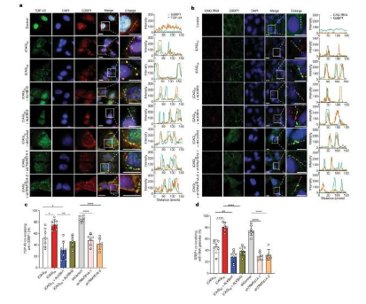 科学家们驯服了致命亨廷顿病的生物触发因素