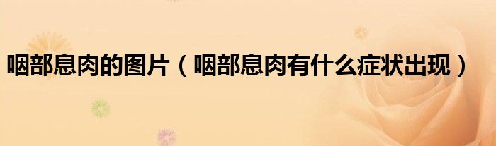咽部息肉的图片（咽部息肉有什么症状出现）