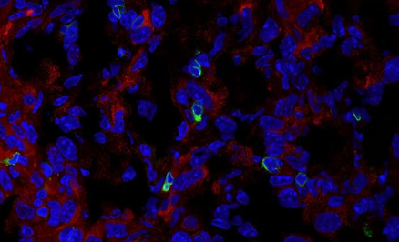在肿瘤相关巨噬细胞中发现的酶检查点