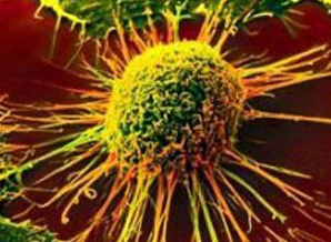 血癌治疗可能会使免疫细胞老化长达 30 年