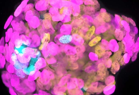 新的培养系统发现早期人类胚胎中的细胞拥挤程度影响细胞身份决策