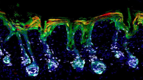 维生素 A 可能在干细胞生物学和伤口修复中发挥核心作用