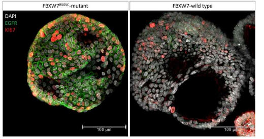 新发现的 FBXW7 突变与结直肠癌中 EGFR 信号传导之间的联系
