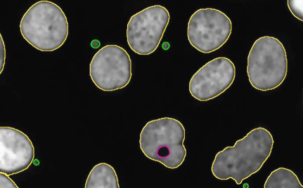 新的生物信息学工具可识别肿瘤细胞的染色体改变