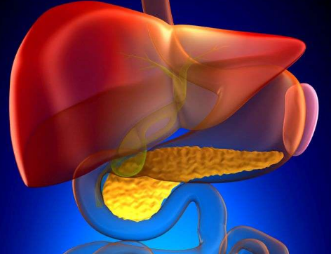 T2DM 慢性胰腺炎和糖尿病也存在类似缺陷