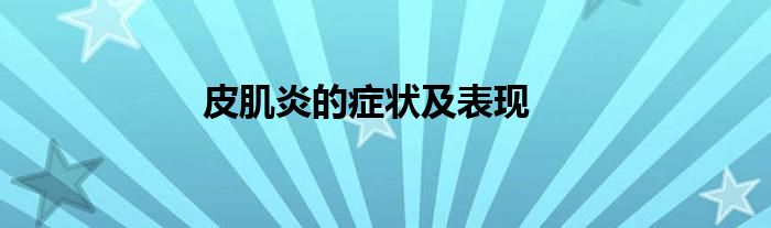 皮肌炎的症状及表现