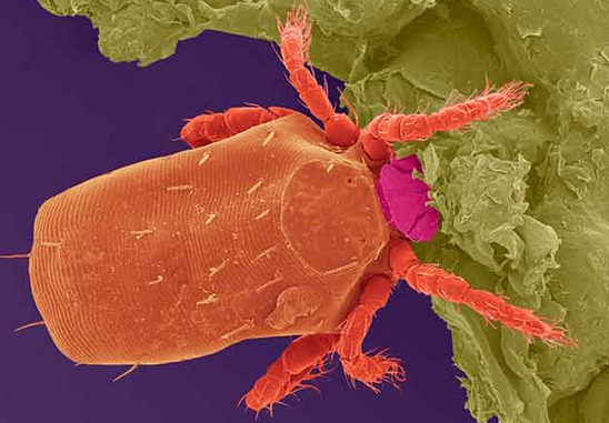 这种微小的 红色的 类似蜘蛛的寄生虫会在某些人身上引发罕见的食物过敏