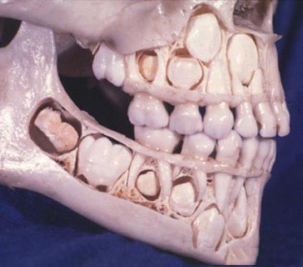 古代捕食者的牙齿可以再生