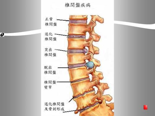 产前手术和细胞疗法组合改善脊柱裂的肢体控制