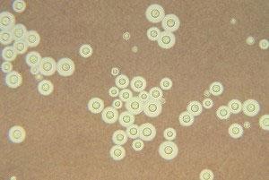 研究确定影响对隐球菌感染的反应的基因组差异