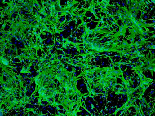 星形胶质细胞帮助大脑建立持久的记忆