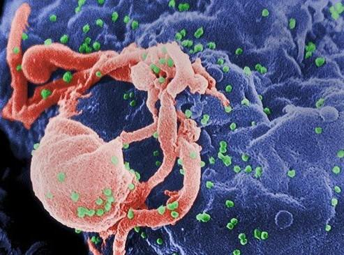 用于治疗癌症的免疫策略是否也可以消灭艾滋病毒感染