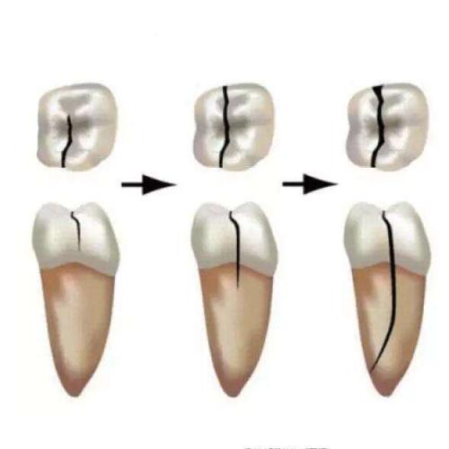 确定的共同起源可以使牙齿再生潜力更接近