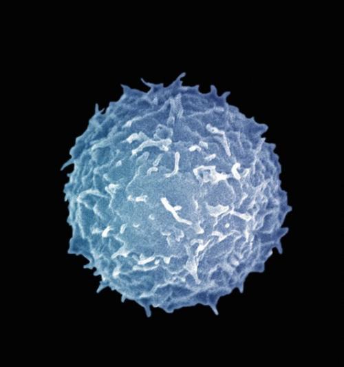 B细胞亚型在对黑素瘤的免疫应答中起重要作用