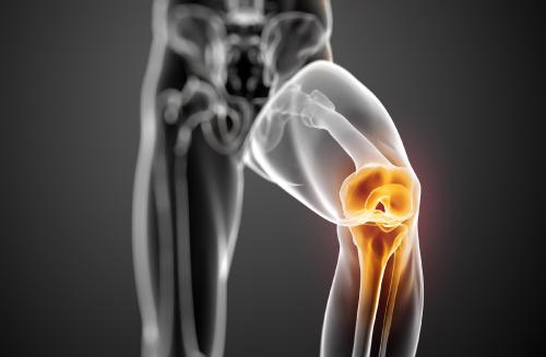 膝关节疼痛与膝关节骨性关节炎成人的活动水平无关