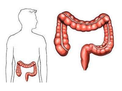 关于结肠癌的9个事实
